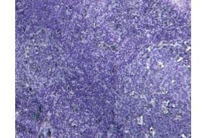 Immunohistochemistry (IHC) image for anti-Myeloid Differentiation Primary Response Gene (88) (MYD88) (Internal Region) antibody (ABIN185362)