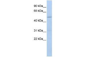 WB Suggested Anti-CECR6 Antibody Titration:  0. (CECR6 Antikörper  (Middle Region))