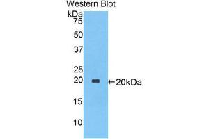 Western Blotting (WB) image for anti-serpin Peptidase Inhibitor, Clade A (Alpha-1 Antiproteinase, Antitrypsin), Member 1 (SERPINA1) (AA 27-181) antibody (ABIN1077773) (SERPINA1 Antikörper  (AA 27-181))