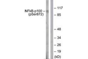 Western blot analysis of extracts from RAW264.