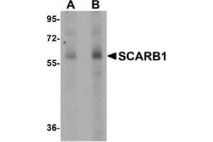 Western Blotting (WB) image for anti-Scavenger Receptor Class B, Member 1 (SCARB1) (N-Term) antibody (ABIN1031556) (SCARB1 Antikörper  (N-Term))