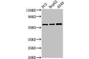 Western Blot Positive WB detected in: PC-3 whole cell lysate, HepG2 whole cell lysate, A549 whole cell lysate All lanes: vnn1 antibody at 3. (VNN1 Antikörper  (AA 97-197))