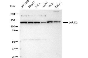 anti-Jumonji, AT Rich Interactive Domain 2 (JARID2) antibody
