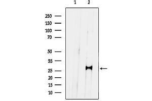 anti-Paired Related Homeobox 1 (PRRX1) (Internal Region) antibody
