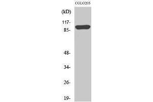 Western Blotting (WB) image for anti-Proteasome (Prosome, Macropain) 26S Subunit, Non-ATPase, 2 (PSMD2) (N-Term) antibody (ABIN3177038) (PSMD2 Antikörper  (N-Term))