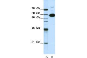 WB Suggested Anti-NONO Antibody Titration:  1. (NONO Antikörper  (C-Term))