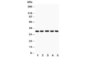 Western blot testing of LOX-1 antibody and Lane 1:  rat liver (OLR1 Antikörper  (Middle Region))