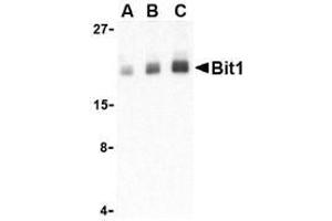 Western blot analysis of Bit1 in Daudi cell lysate with AP30153PU-N Bit1 antibody at (A) 1, (B) 2, and (C) 4 μg/ml. (PTRH2 Antikörper  (Middle Region))