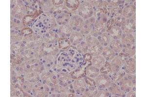 Immunohistochemistry (Paraffin-embedded Sections) (IHC (p)) image for anti-conserved Helix-Loop-Helix Ubiquitous Kinase (CHUK) antibody (ABIN7606904)