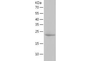 Western Blotting (WB) image for Proteasome (Prosome, Macropain) 26S Subunit, Non-ATPase, 9 (PSMD9) (AA 1-223) protein (His tag) (ABIN7284230) (PSMD9 Protein (AA 1-223) (His tag))