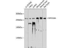 Western blot analysis of extracts of various cell lines, using MYO18A antibody (ABIN6129619, ABIN6144276, ABIN6144277 and ABIN6224863) at 1:1000 dilution.