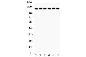 Western blot testing of PAPP-A antibody and human samples 1:  placenta (PAPPA Antikörper  (AA 95-388))