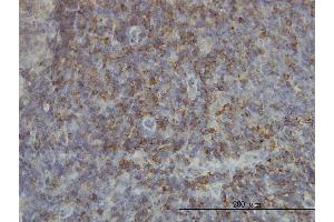 Immunoperoxidase of monoclonal antibody to SH2D3C on formalin-fixed paraffin-embedded human lymph node. (SH2D3C Antikörper  (AA 1-110))