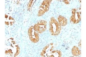 IHC testing of FFPE human rectum tissue with Villin antibody (clone VIL1/1314). (Villin 1 Antikörper  (AA 179-311))