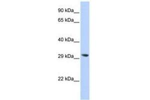 Image no. 1 for anti-Lysophospholipase II (LYPLA2) (N-Term) antibody (ABIN6741477) (LYPLA2 Antikörper  (N-Term))