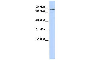 WB Suggested Anti-ZNF366 Antibody Titration:  0. (ZNF366 Antikörper  (C-Term))