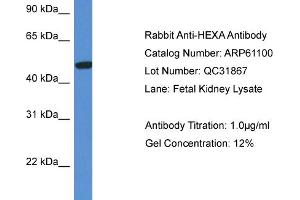 Western Blotting (WB) image for anti-Hexosaminidase A (HEXA) (C-Term) antibody (ABIN2788673)