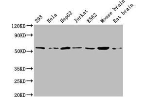 Western Blot Positive WB detected in: 293 whole cell lysate, Hela whole cell lysate, HepG2 whole cell lysate, Jurkat whole cell lysate, K562 whole cell lysate, Mouse brain tissue, Rat brain tissue All lanes: ATP5A1 antibody at 1:2000 Secondary Goat polyclonal to rabbit IgG at 1/50000 dilution Predicted band size: 60, 55, 58 kDa Observed band size: 60 kDa (ATP5F1A (AA 59-257) Antikörper)