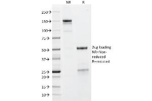 SDS-PAGE Analysis Purified GP2 Mouse Monoclonal Antibody (GP2/1712). (GP2 Antikörper  (AA 35-179))