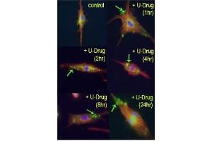 Immunofluorescence (IF) image for anti-Microtubule-Associated Protein 1 Light Chain 3 beta (MAP1LC3B) (AA 89-122), (cleaved) antibody (ABIN388484)