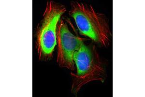 Western Blotting (WB) image for anti-Solute Carrier Family 2 (Facilitated Glucose Transporter), Member 4 (SLC2A4) (AA 224-353) antibody (ABIN1846354)