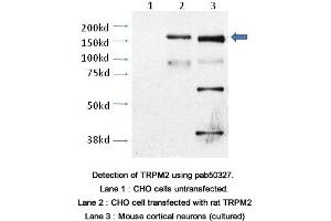 Image no. 2 for anti-Transient Receptor Potential Cation Channel, Subfamily M, Member 2 (TRPM2) (AA 1430-1508), (C-Term) antibody (ABIN363636) (TRPM2 Antikörper  (C-Term))