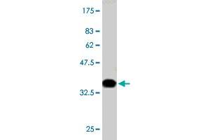 Western Blot detection against Immunogen (36. (PIK3R4 Antikörper  (AA 1259-1358))