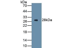 Detection of Recombinant ICAM2, Human using Polyclonal Antibody to Intercellular Adhesion Molecule 2 (ICAM2) (ICAM2 Antikörper  (AA 34-241))