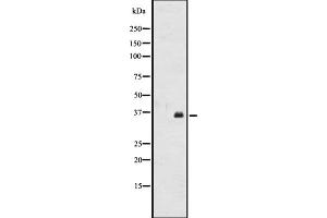 Western blot analysis of OR2A12 expression in CEM cell line lysates ,The lane on the left is treated with the antigen-specific peptide. (OR2A12 Antikörper  (C-Term))