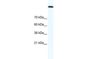 Western Blotting (WB) image for anti-Topoisomerase (DNA) II alpha 170kDa (TOP2A) antibody (ABIN2463687) (Topoisomerase II alpha Antikörper)
