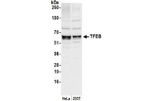 Western Blotting (WB) image for anti-Transcription Factor EB (TFEB) (AA 325-375) antibody (ABIN7450813)