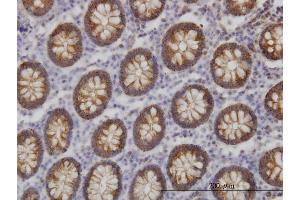 Immunostaining (ISt) image for anti-BAI1-Associated Protein 2-Like-1 (BAIAP2L1) (AA 398-511) antibody (ABIN565967)
