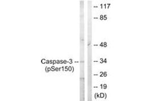 Western blot analysis of extracts from Jurkat cells treated with Etoposide 25uM 60', using Caspase 3 (Phospho-Ser150) Antibody. (Caspase 3 Antikörper  (pSer150))