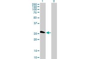 Western Blot analysis of LOC391746 expression in transfected 293T cell line by LOC391746 MaxPab polyclonal antibody. (TAF11L4 Antikörper  (AA 1-198))