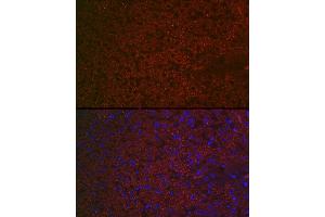 Immunofluorescence (IF) image for anti-Retinoic Acid Receptor Responder (Tazarotene Induced) 2 (RARRES2) (AA 17-163) antibody (ABIN6146704)