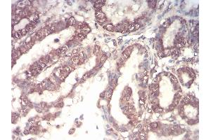 Immunohistochemistry (IHC) image for anti-Colony Stimulating Factor 3 (Granulocyte) (CSF3) (AA 1-207) antibody (ABIN5863249) (G-CSF Antikörper  (AA 1-207))
