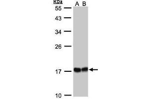 WB Image Sample(30 ug whole cell lysate) A:293T whole cell lysate B:A431, 12% SDS PAGE antibody diluted at 1:1000 (HSPB8 Antikörper  (C-Term))