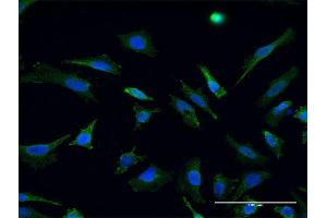 Immunofluorescence of monoclonal antibody to RHOT1 on HeLa cell. (RHOT1 Antikörper  (AA 483-580))