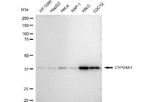 Western blotting analysis using CYP24A1 antibody (ABIN7798256).