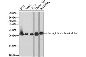 Western blot analysis of extracts of various cell lines, using DHFR Rabbit mAb (ABIN7266764) at 1:1000 dilution. (Dihydrofolate Reductase Antikörper)