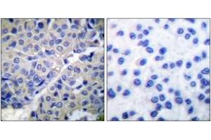 anti-Synaptotagmin (SYT) (AA 276-325), (pSer309) antibody