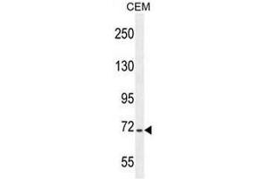 STIM1 Antibody (C-term) western blot analysis in CEM cell line lysates (35µg/lane). (STIM1 Antikörper  (C-Term))