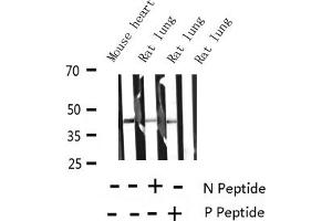 Western blot analysis of Phospho-MARCKS (Ser158) Antibody expression in mouse heart and rat lung tissues lysates. (MARCKS Antikörper  (pSer159))