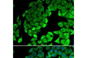 Immunofluorescence analysis of MCF-7 cells using RPL14 Polyclonal Antibody (RPL14 Antikörper)