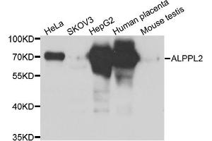 Western blot analysis of extracts of various cell lines, using ALPPL2 antibody (ABIN5975268) at 1/1000 dilution. (ALPPL2 Antikörper)
