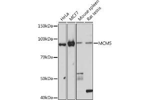 Western blot analysis of extracts of various cell lines, using MCM5 Rabbit mAb (ABIN7268543) at 1:1000 dilution. (MCM5 Antikörper)