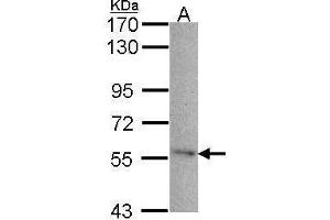 Western Blotting (WB) image for anti-24-Dehydrocholesterol Reductase (DHCR24) antibody (ABIN2855685)