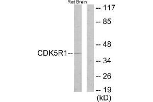 Western blot analysis of extracts from rat brain cells, using CDK5R1 antibody. (CDK5R1 Antikörper  (N-Term))