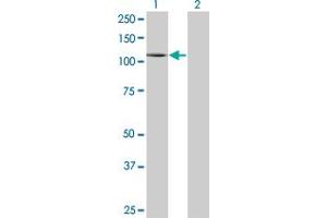 Western Blot analysis of PLD1 expression in transfected 293T cell line by PLD1 monoclonal antibody (M01), clone 2F3. (PLD1 Antikörper  (AA 965-1074))