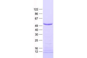 Western Blotting (WB) image for F-Box Protein 22 (FBXO22) protein (His tag) (ABIN2720948)